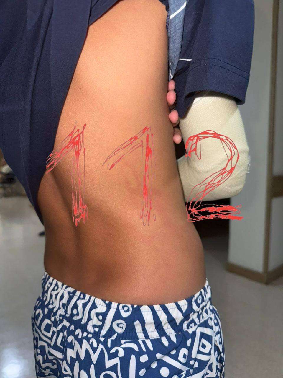 В Турции спортсмен-силовик избил 12-летнего мальчика из Оренбурга 